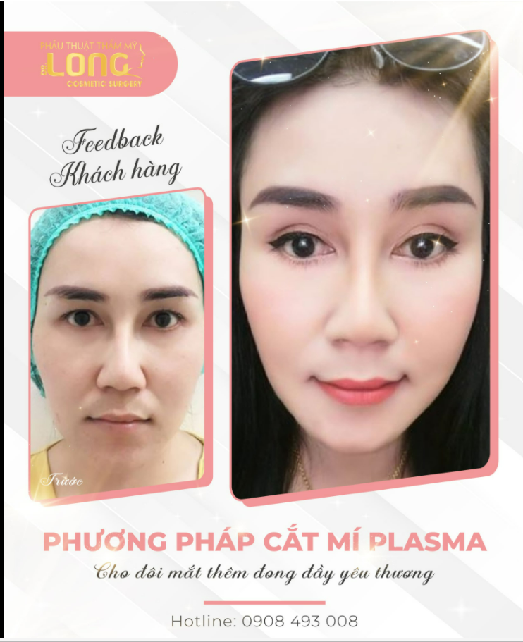 KHÔNG PHẢI LÀ NẮNG NHƯNG VẪN ĐẸP CHÓI CHANG