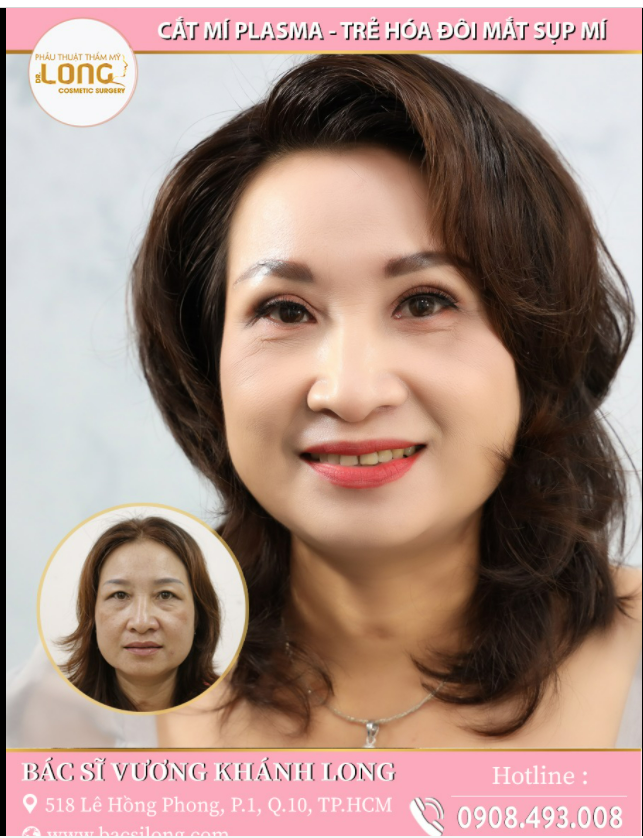 KHUÔN MẶT THAY ĐỔI CHỈ SAU 1 LẦN CẮT MÍ