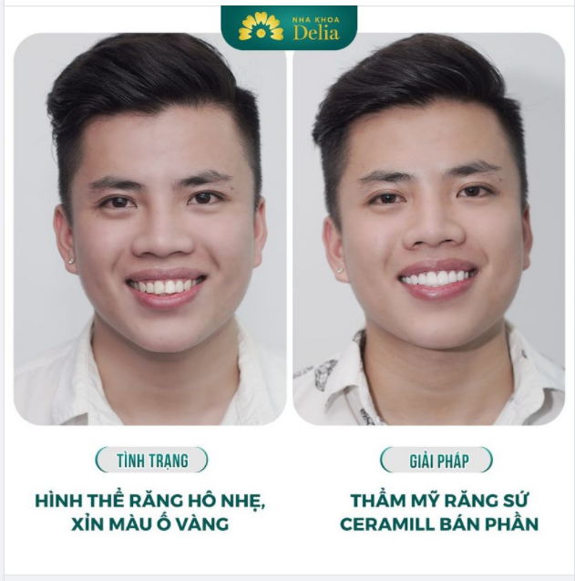 Kiến tạo nụ cười rạng rỡ - Tìm lại bản lĩnh phái mạnh