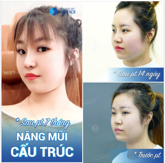 Kiêu sa là bên đó, Xinh duyên là bên này.