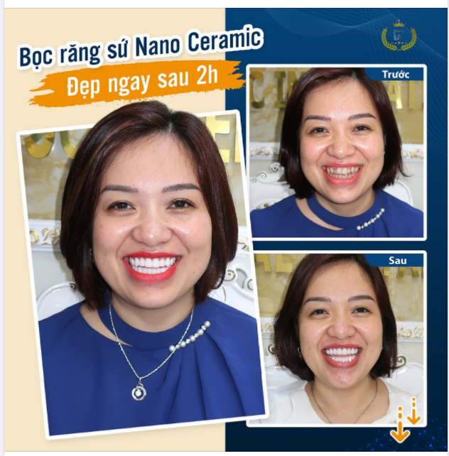 LÀ PHỤ NỮ NHẤT ĐỊNH PHẢI LUÔN CƯỜI RẠNG RỠ!