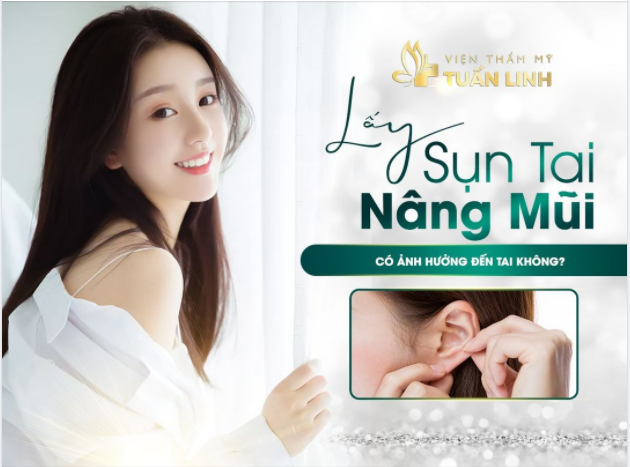 Lấy sụn tai nâng mũi có ảnh hưởng đến tai không
