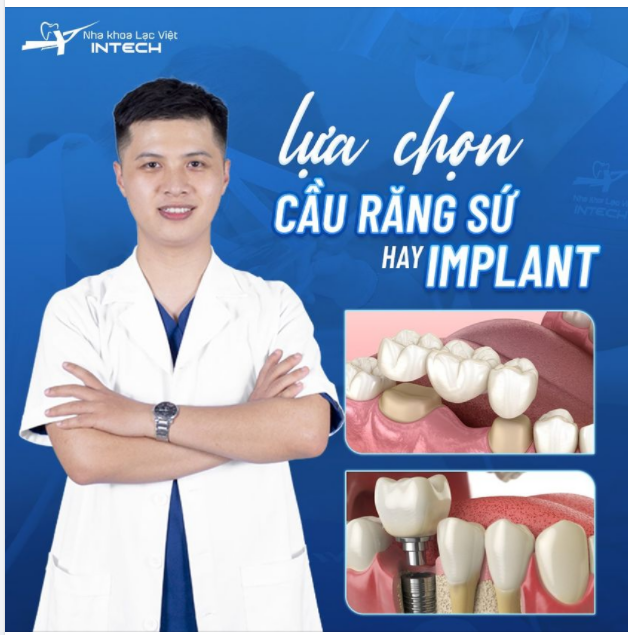 LỰA CHỌN CẦU RĂNG SỨ HAY IMPLANT