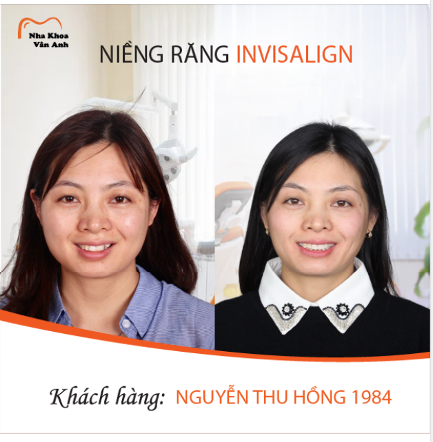 LỰA CHỌN INVISALIGN, CHỊ THU HỒNG TÌM THẤY PHIÊN BẢN NỤ CƯỜI HOÀN HẢO CỦA CHÍNH MÌNH