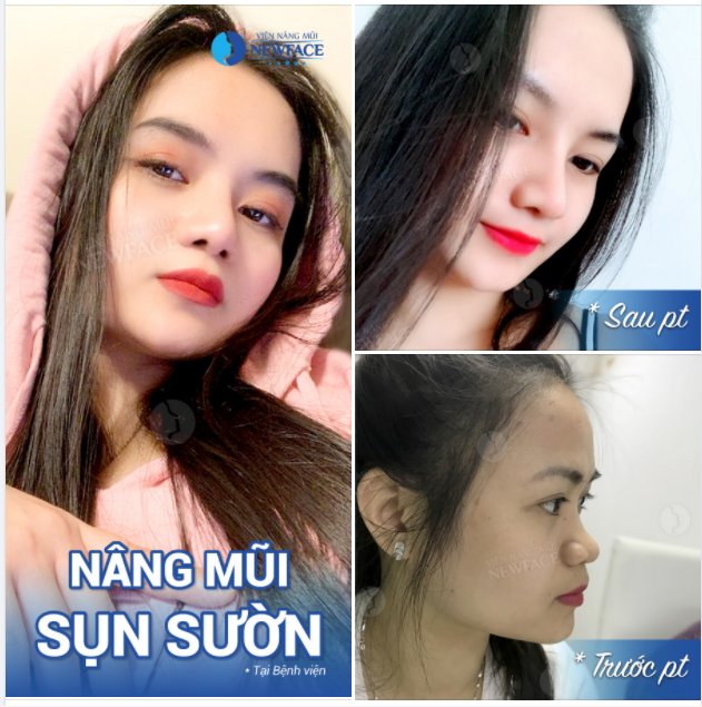 Mặc dù làm việc vất vả Em cũng chẳng cần gả cho ai