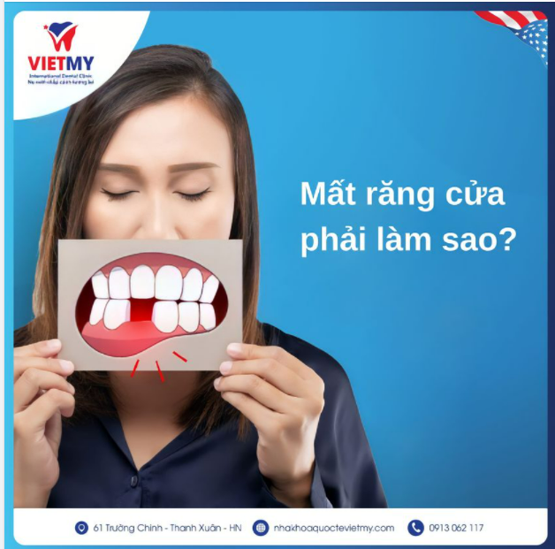 MẤT RĂNG CỬA PHẢI LÀM SAO