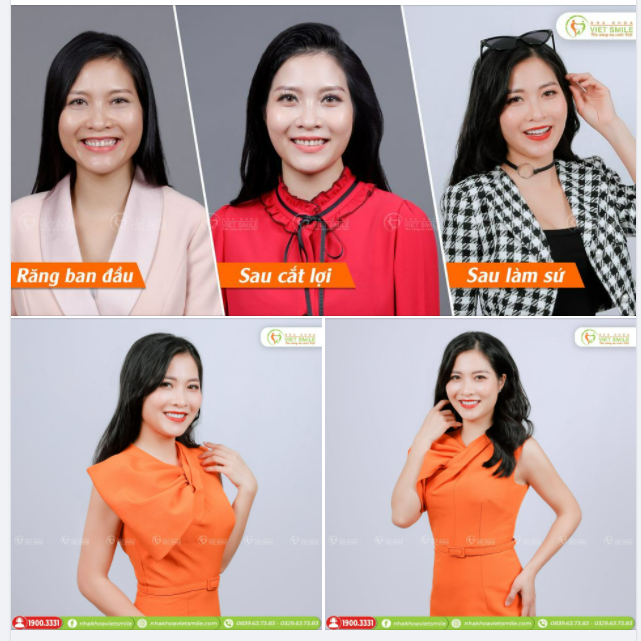 MC BÍCH THẢO VÀ HÀNH TRÌNH HOÀN THIỆN NỤ CƯỜI TẠI VIET SMILE