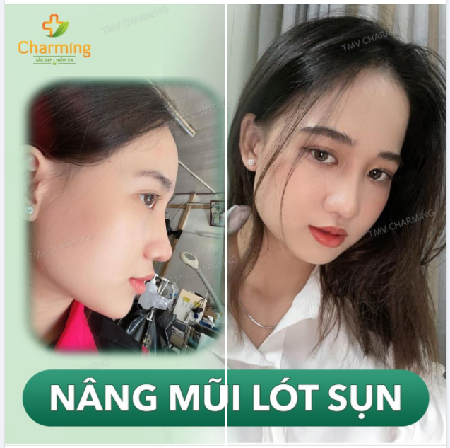 Mẹ dặn ra đường có ai chỉ ra chỗ nào mình chưa hoàn hảo gì mình thì mình phải chỉnh.