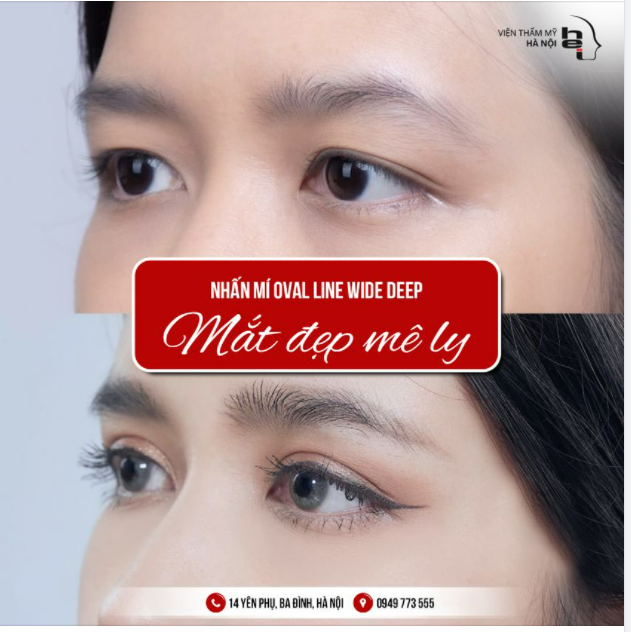 MÍ ĐẸP MÊ LY VỚI NHẤN MÍ OVAL LINE WIDE DEEP