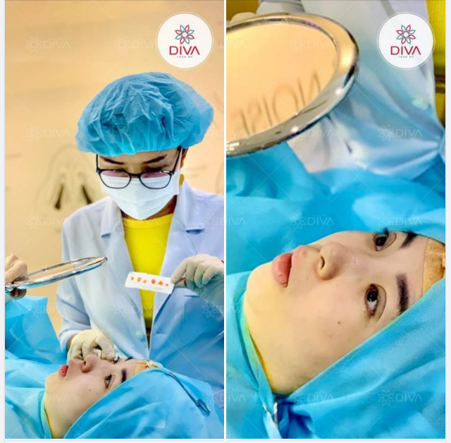MÍ ĐẸP XUẤT SẮC NGAY SAU THỰC HIỆN
