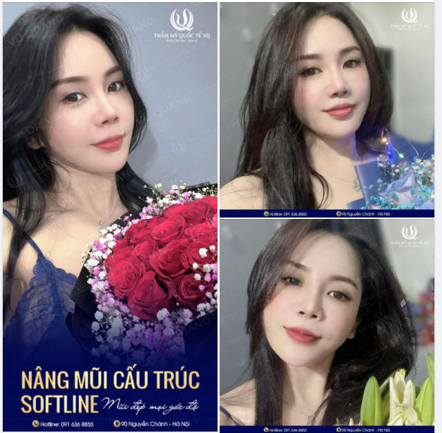 Mũi đẹp như ý - Rạng ngời xinh tươi