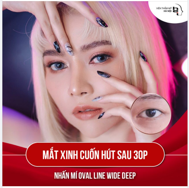 Muốn có mí xinh đến ngay Viện thẩm mỹ Hà Nội
