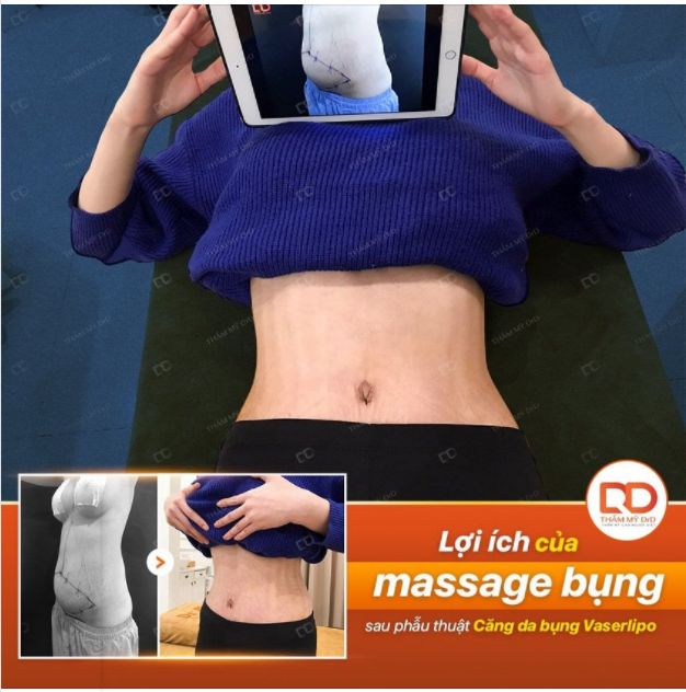 Nắng lên rực rỡ, tranh thủ sử dụng ngay gói chăm sóc đặc biệt sau phẫu thuật Căng da bụng Vaserlipo.