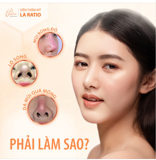 NÂNG MŨI MEGA S XÓA TAN NỖI LO MŨI HỎNG