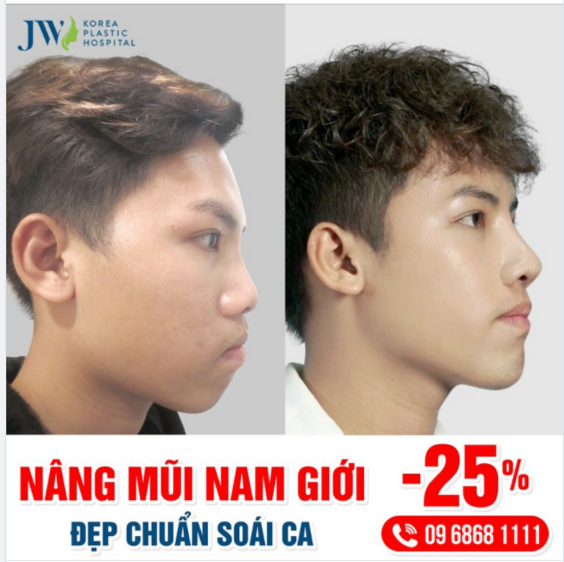 NÂNG MŨI NAM GIỚI ĐẸP, TỰ TIN, NÂNG TẦM BẢN LĨNH PHÁI MẠNH