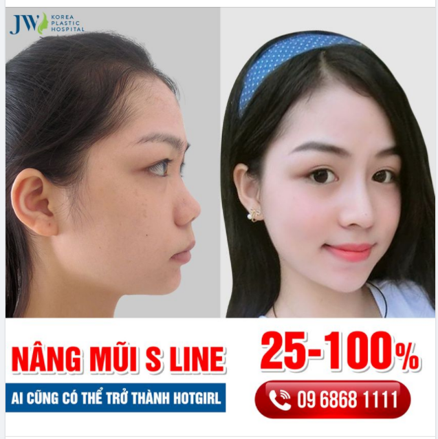 NÂNG MŨI S LINE – TRỜ THÀNH HOTGIRL VẠN NGƯỜI MÊ