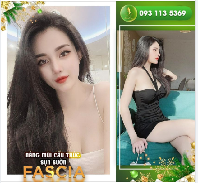Nâng mũi sụn sườn - dáng mũi phù hợp cho khách hàng MŨI KHÓ, MŨI HỎNG, MŨI BIẾN DẠNG, MŨI NGẮN, DỊ ỨNG...