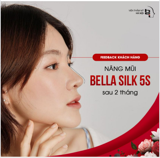 NÂNG MŨI XONG THẤY MẶT SANG CHẢNH HƠN, TỰ TIN CHỤP ẢNH GÓC NÀO CŨNG ĐỀU XINH Ạ!