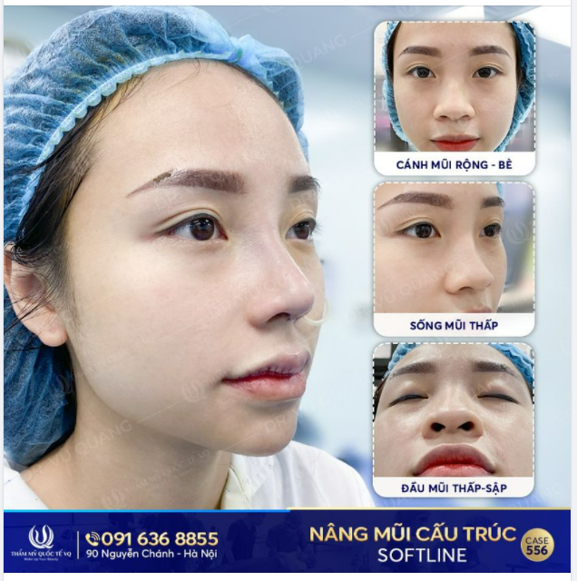 Nàng thơ 2000 - nhìn là mê