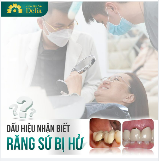 Nếu có những dấu hiệu dưới đây, chắc chắn răng sứ của bạn đã bị hỏng vì lựa chọn cơ sở NHA KHOA KHÔNG UY TÍN!