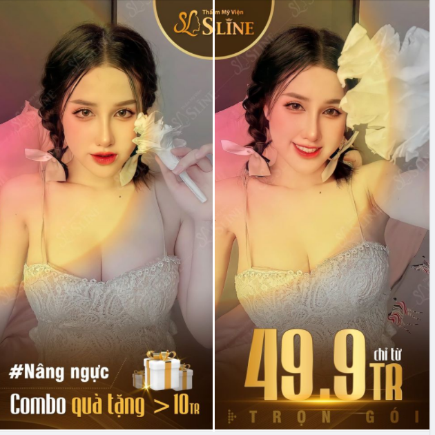 NGỰC ĐẸP TRỌN GÓI CHỈ TỪ 49,9TR