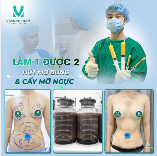 NGỰC NỞ EO THON CHỈ SAU 1 LẦN THỰC HIỆN