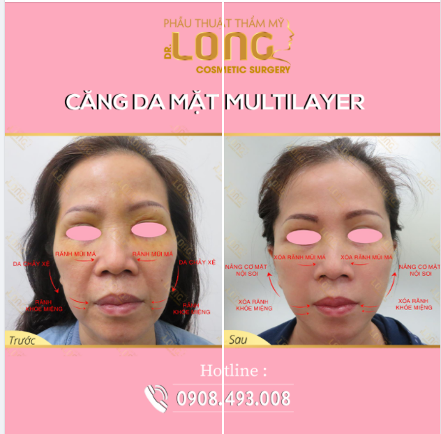 NGƯỜI SỞ HỮU LÀN DA TƯƠI TRẺ LUÔN CÓ BÍ QUYẾT RIÊNG