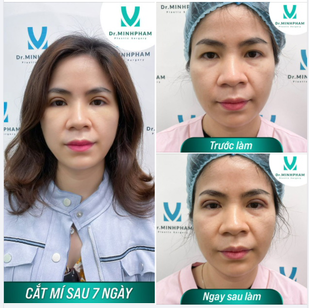 Người ta nói Đôi mắt là cửa sổ tâm hồn quả không sai chút nào! Nhìn chị khách dưới đây là biết!!!