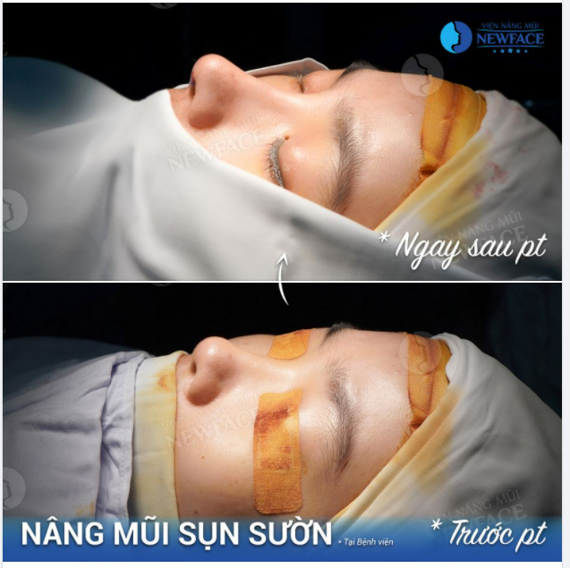 NHẮM MẮT 1 CÁI, MỞ MẮT RA ĐÃ THẤY MÌNH ĐẸP
