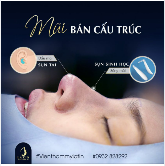 Nhiều anh chị khách hàng nhắn tin cho page với một thắc mắc chung - Nâng mũi bán cấu trúc là gì ạ