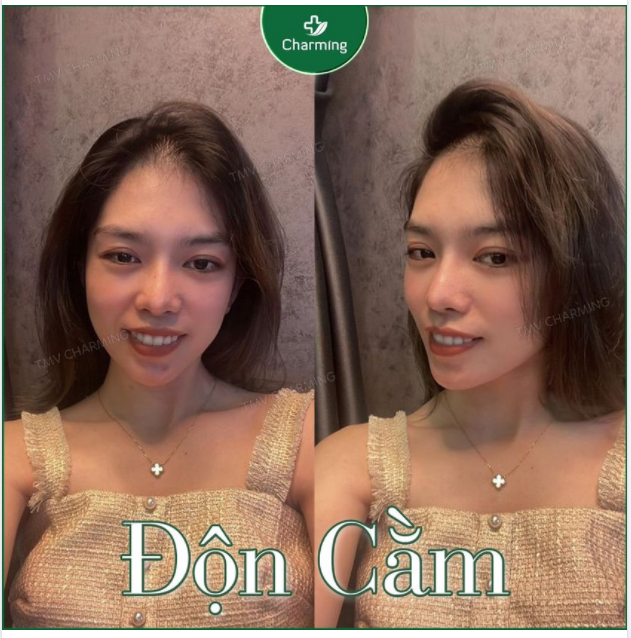 Nhìn thẳng nhìn nghiêng, sao nhìn góc nào nàng khách của Charming cũng xinh hết vậy nè!!!
