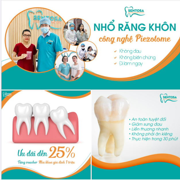 NHỔ RĂNG 8 ​​​​​​​ BẰNG MÁY SIÊU ÂM PIEZOTOME CÔNG NGHỆ HIỆN ĐẠI NHẤT HIỆN NAY