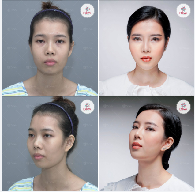 NHƯ THẾ NÀO LÀ LÀM ĐẸP TỰ NHIÊN, TINH TẾ