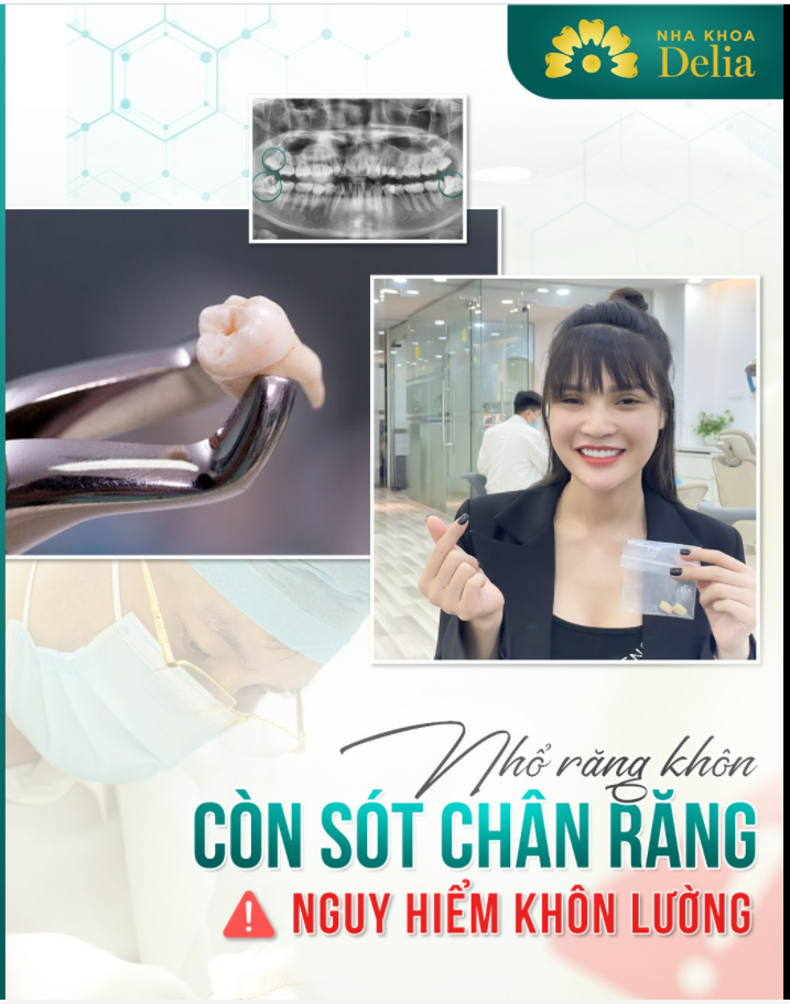 Những lưu ý trước khi chọn cơ sở thực hiện nhổ răng khôn