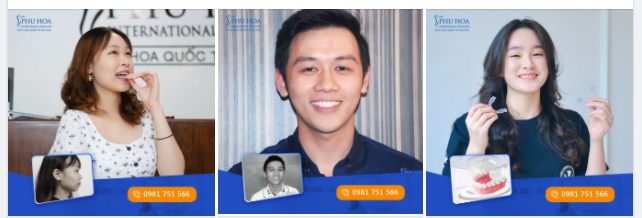 NIỀNG NHANH, ĐẸP SỚM VỚI NIỀNG RĂNG INVISALIGN