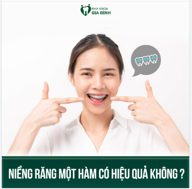 NIỀNG RĂNG 1 HÀM CÓ HIỆU QUẢ KHÔNG