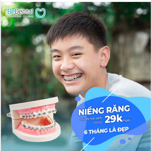 Niềng răng chi phí chỉ bằng tô bún 18 suất đăng ký sớm nhất