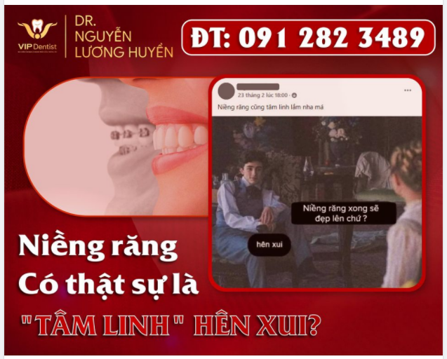 NIỀNG RĂNG CÓ THẬT SỰ TÂM LINH HÊN XUI