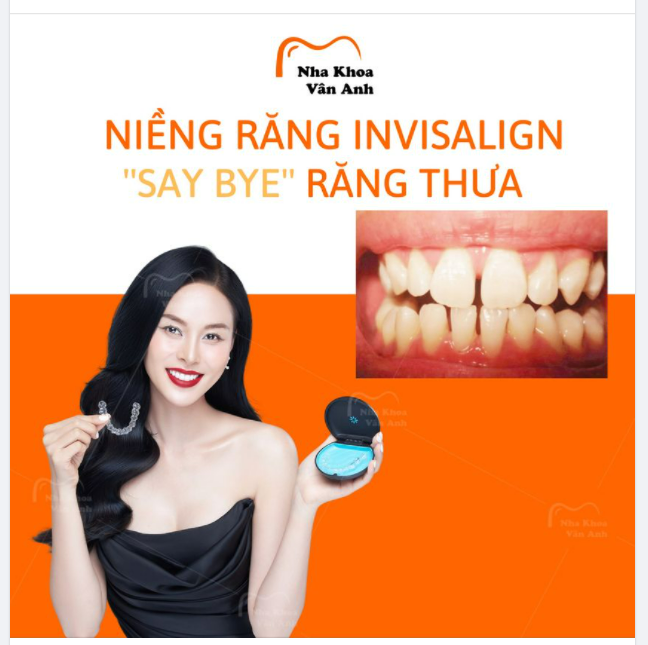 NIỀNG RĂNG INVISALIGN “SAY BYE” RĂNG THƯA