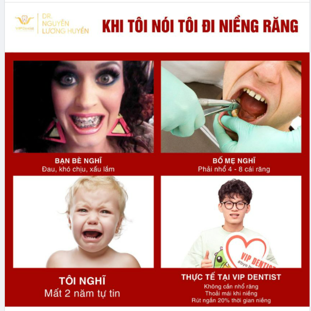 NIỀNG RĂNG KHÔNG CẦN NHỔ RĂNG