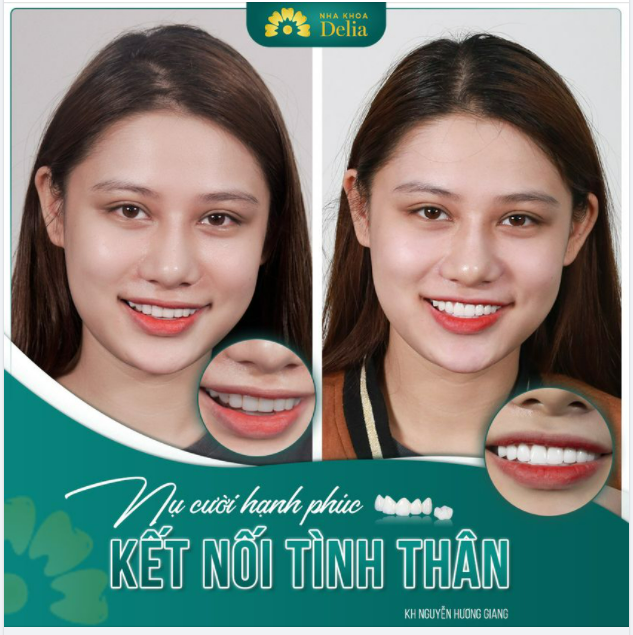 Nụ cười hạnh phúc - Kết nối tình thân
