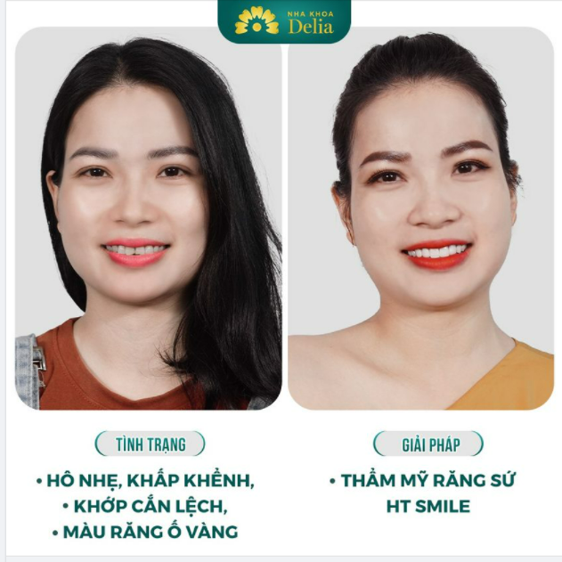 Nụ cười Hạnh Phúc - Lưu nét Thanh Xuân
