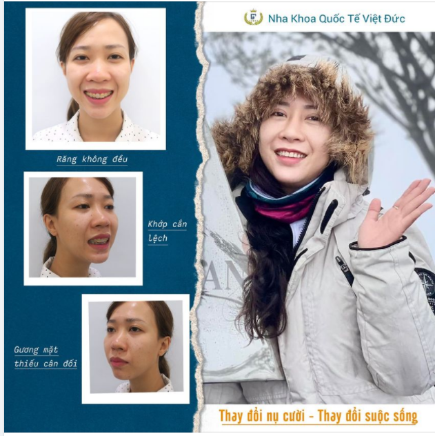 NỤ CƯỜI MỚI - TỰ TIN CHINH PHỤC THẾ GIỚI