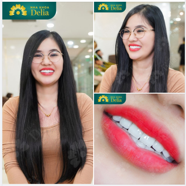 Nụ cười rạng rỡ của bạn cũng là hạnh phúc của những người thân yêu