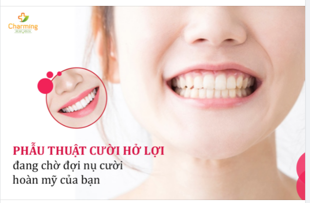 PHẪU THUẬT CƯỜI HỞ LỢI ĐANG CHỜ ĐỢI NỤ CƯỜI HOÀN MỸ CỦA BẠN