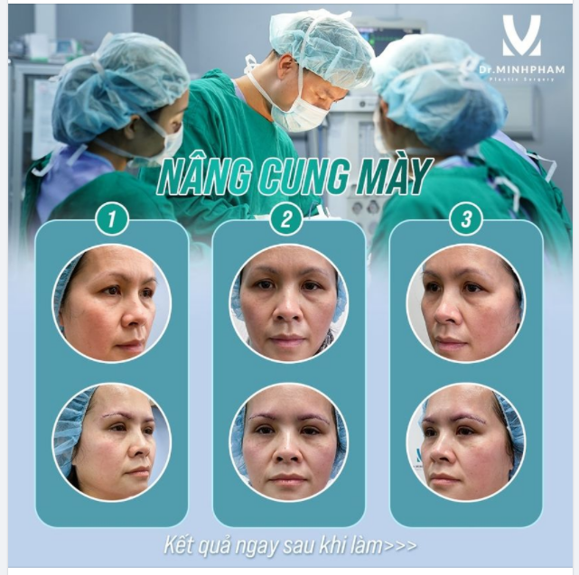 PHƯƠNG PHÁP NÂNG CUNG MÀY LÀ NHƯ THẾ NÀO