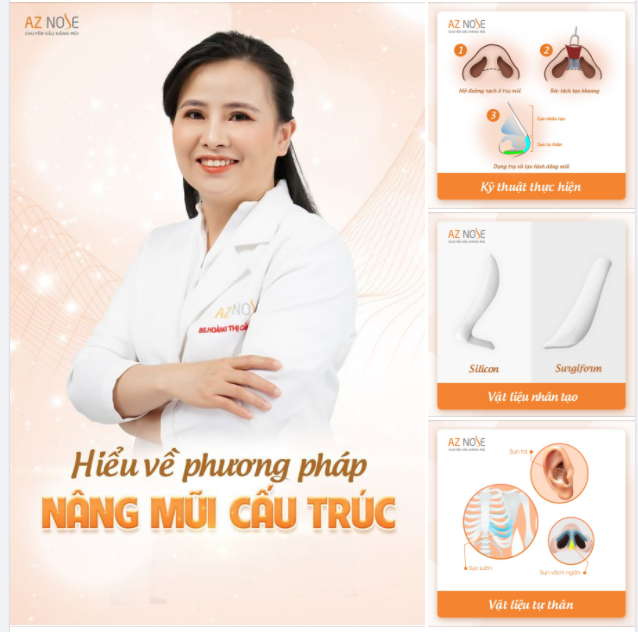 Phương pháp nâng mũi cấu trúc có gì đặc biệt