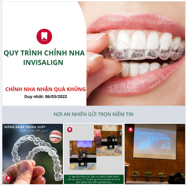 QUY TRÌNH CHỈNH NHA INVISALIGN