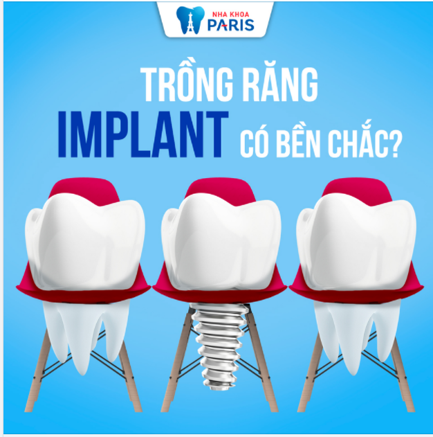 RĂNG IMPLANT CÓ KHOẺ HƠN RĂNG THẬT