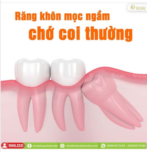 RĂNG KHÔN MỌC NGẦM CHỚ COI THƯỜNG!!